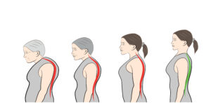 A woman with different types of back pain.